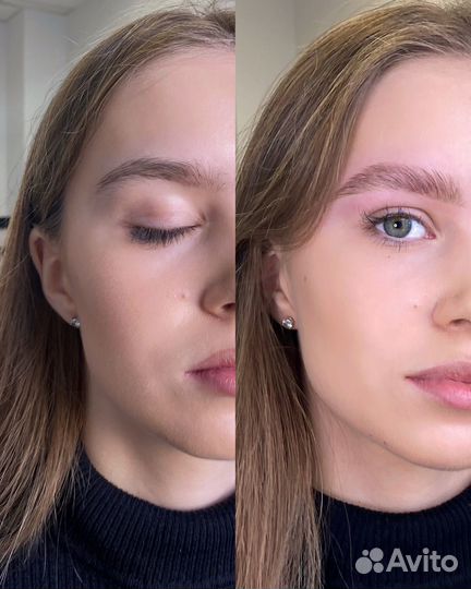 Брови Бугры