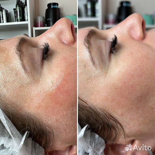 Сахарное моделирование тела, массаж