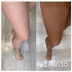 Моментальный загар