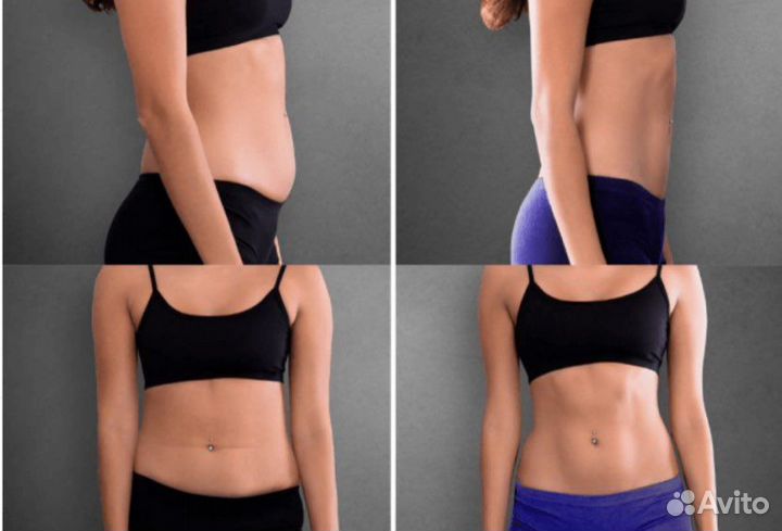 Emsculpt прокачка мышц и жиросжигание