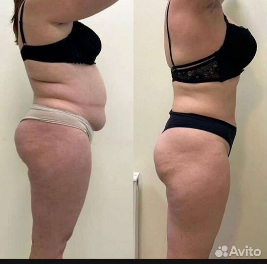 Массаж-Коррекция фигуры