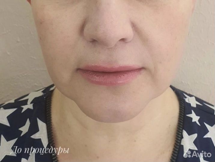 Услуги косметолога