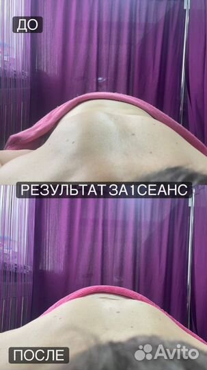 Биоэнергомассаж