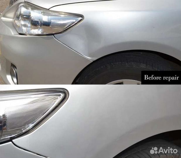 Набор для удаления вмятин