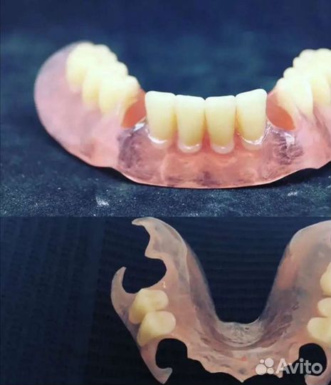 Ремонт починка и изготовление протезов