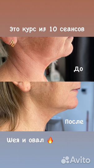 Массаж лица и тела