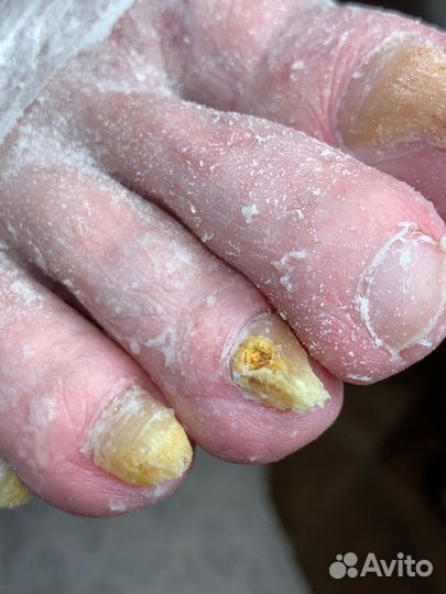 Услуги подолога