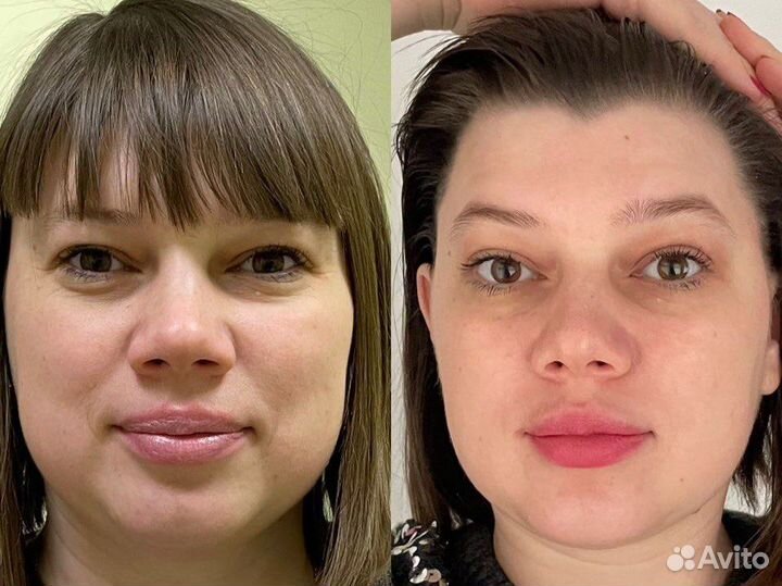 Массаж лица