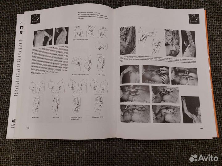 Я. Золтан - Пересадка Кожи. Состояние Люкс