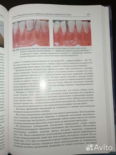 Заболевания пародонта А.И.Грудянов