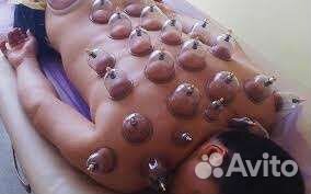 Вакуумные банки с насосом для массажа и хиджамы