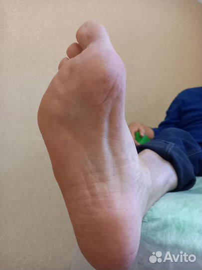 Медицинский педикюр