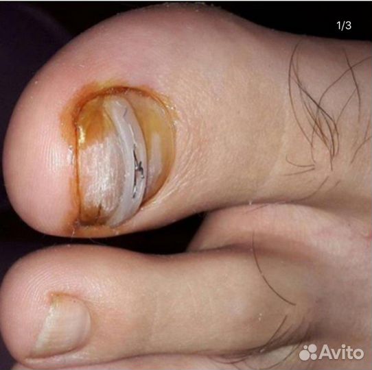 Маникюр шеллак, педикюр