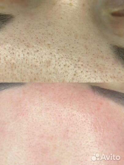 Услуги косметолога