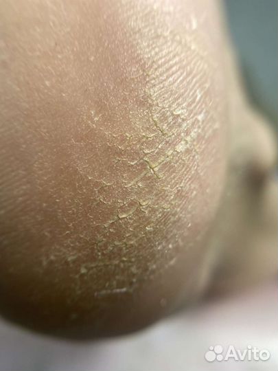 Маникюр педикюр