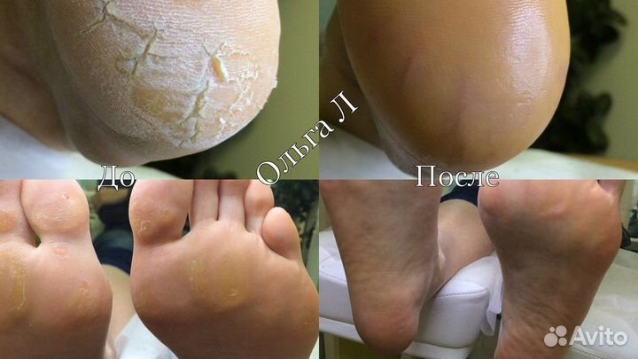 От классики педикюра до подологии