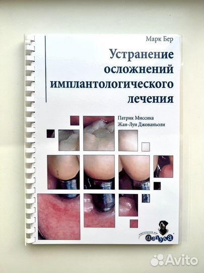Устранение осложнений имплантологического лечения