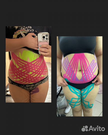 Тейпирование тела и лица