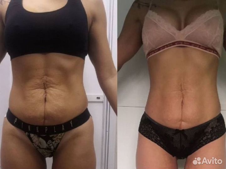 Требуются модели /массаж/кавитация