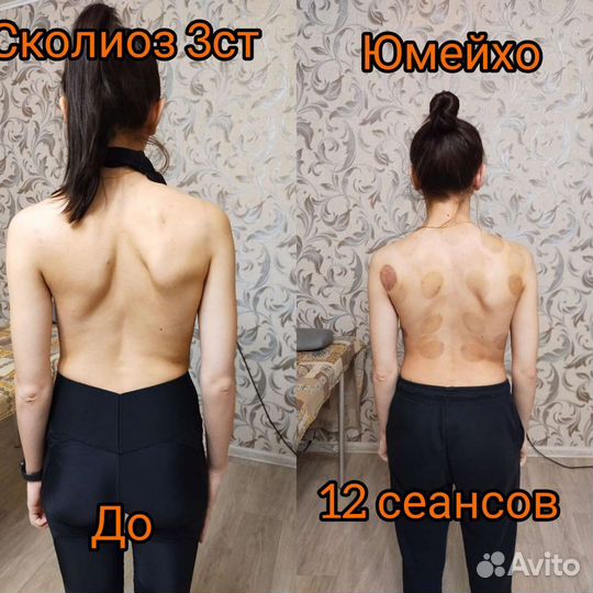 Сертификат на массаж