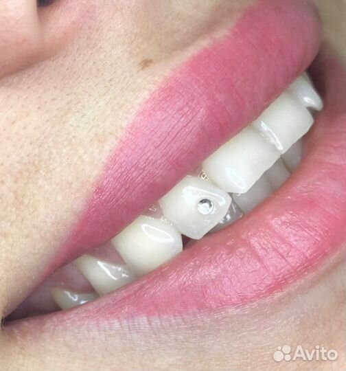 Материалы для установки скайсов