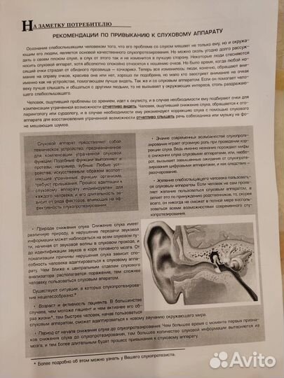 Слуховой аппарат