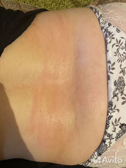 Депиляция воском