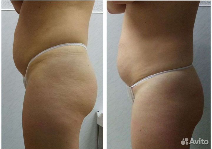 Коррекция лица и тела