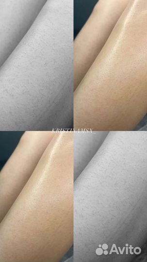 Мужская и женская депиляция воском