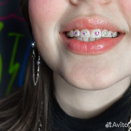 Установка скайсов, скайсы