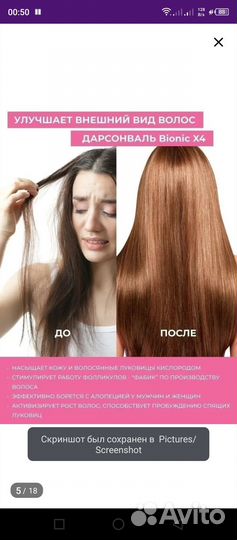 Дарсонваль новый