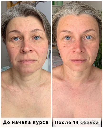 Массаж лица и тела