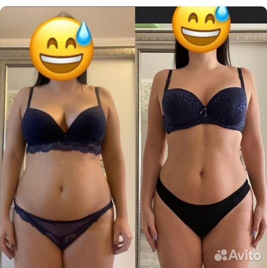 LPG массаж Аппаратный массаж