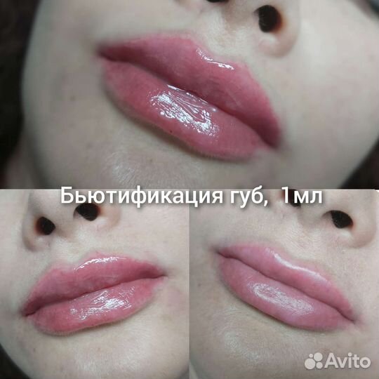 Бьютификация губ