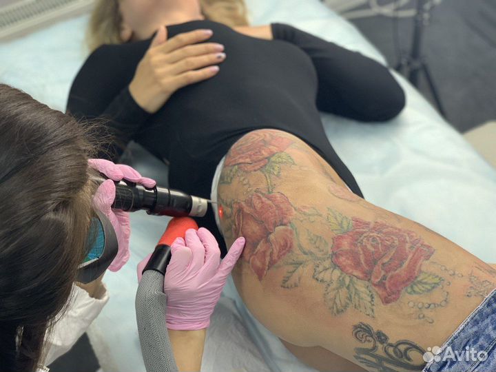 Удаление тату / Результат сразу