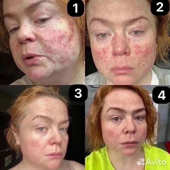 Biodrone nl для здоровья