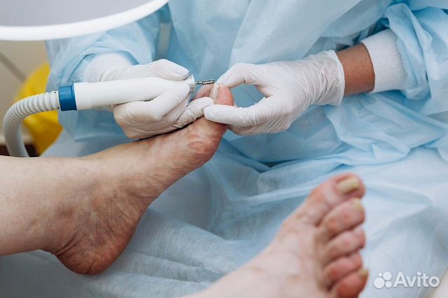 Подологический педикюр