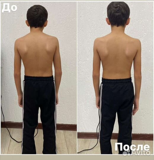 Остеопат. Массаж остеопатическими техниками