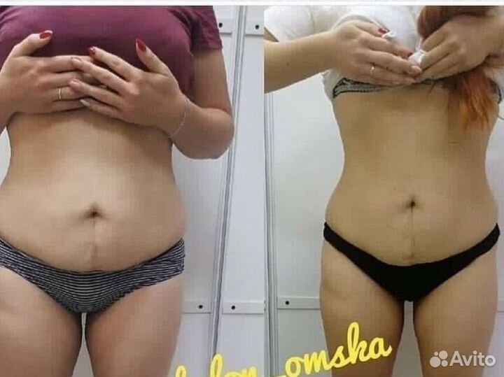 Требуются модели /массаж/кавитация