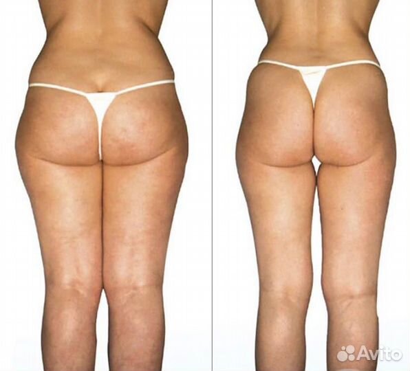 Гидромассаж похудение