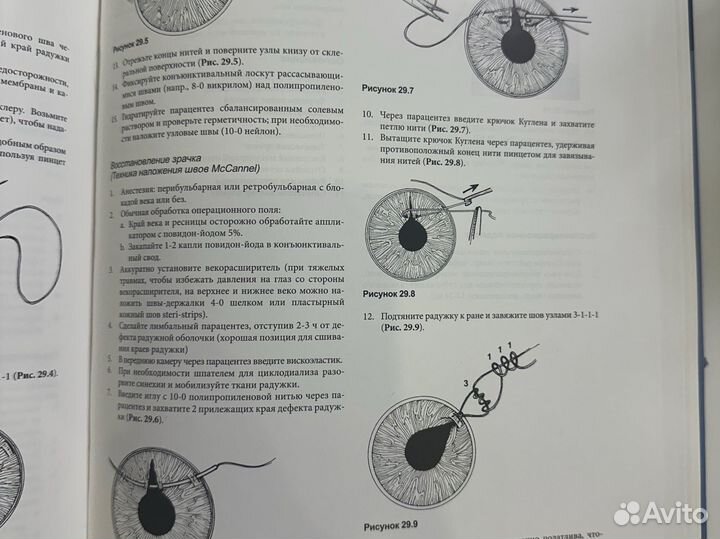 Офтальмохирургия