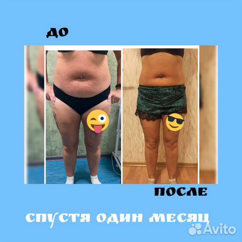 Криолиполиз услуги