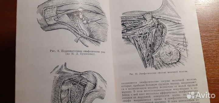 Рак молочной железы Янишевский Ф.И