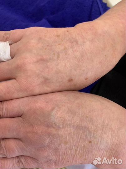 Холодная плазма