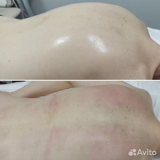 Обучение массажу