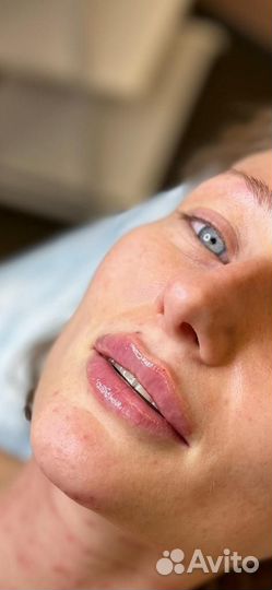 Модель на увеличения губ