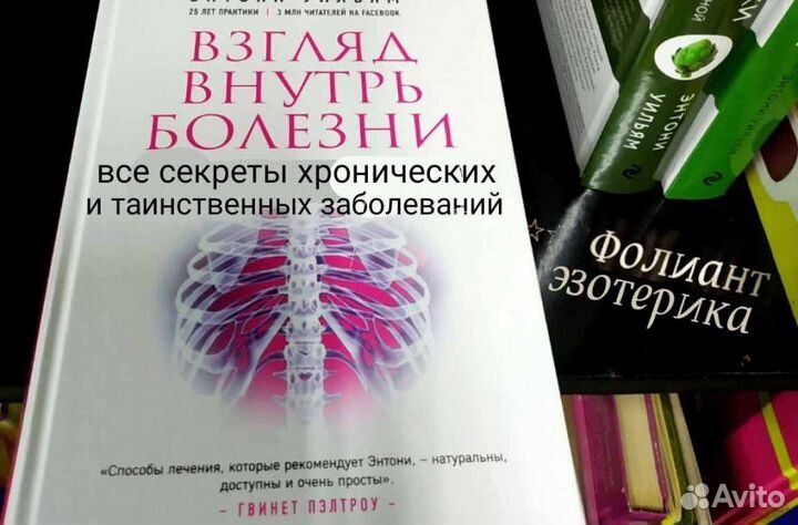 Энтони Уильям Взгляд внутрь болезни книга