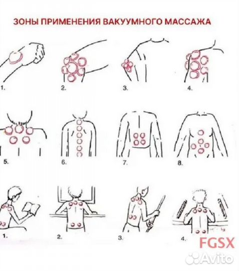 Вакуумные банки, 12 штук