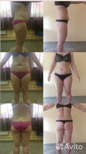 Аппаратная коррекция фигуры