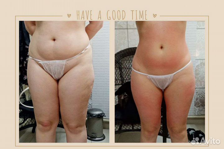 Антицеллюлитный массаж